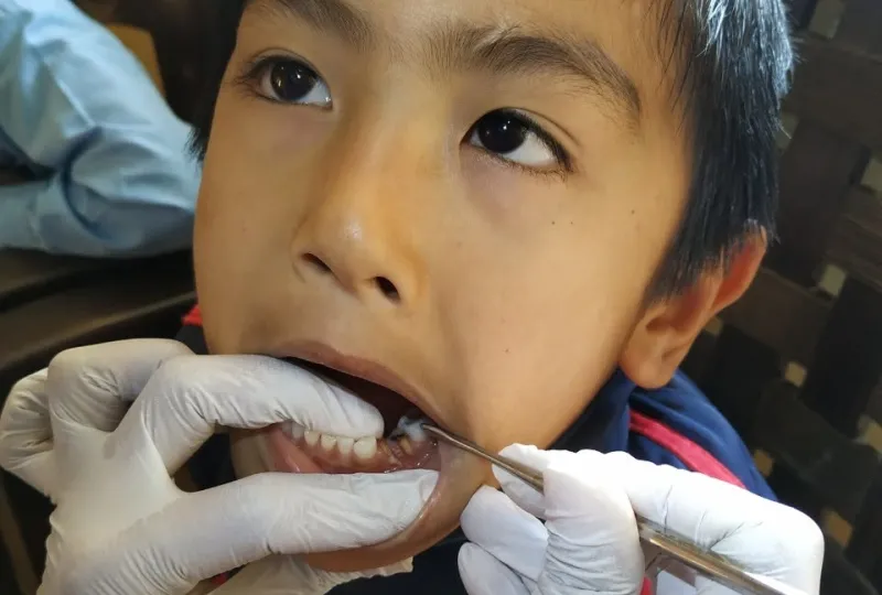 School Oral Health Screening & Distribution Camp
